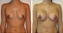 Before & After Photos